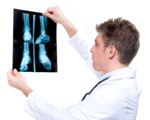 peesontsteking voet diagnose